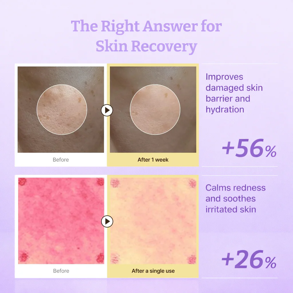 ELEVARE PDRN Active Renew Cream – NEW YEAR OFFER - Image 10