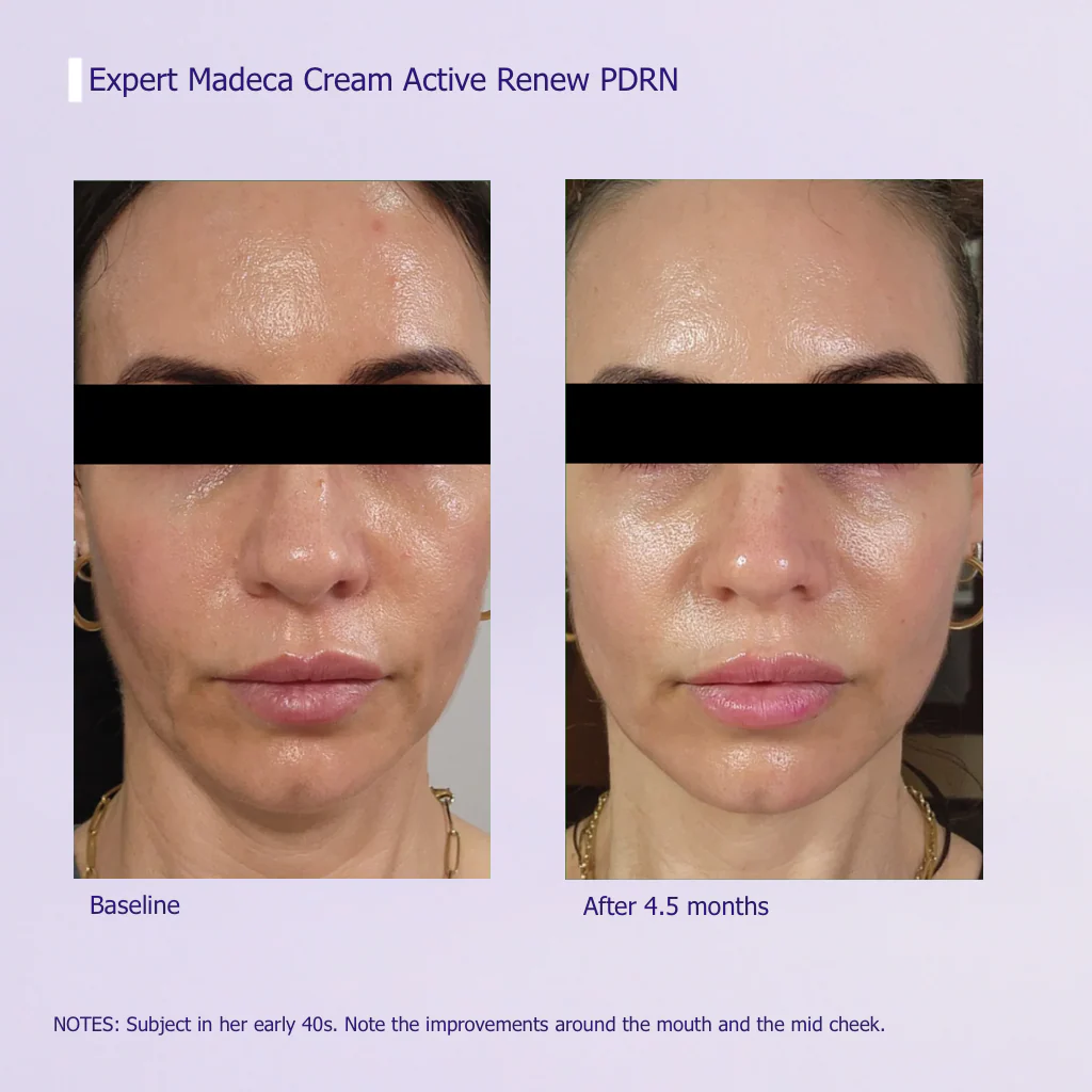 Expert PDRN Firming Cream — Rebuild Elasticity at Any Age - Image 8