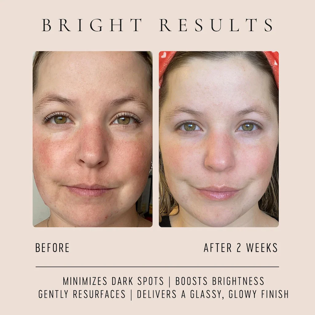 Gentle Vitamin C Serum - Image 11