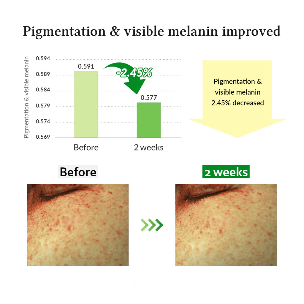 Gentle Vitamin C Serum - Image 4