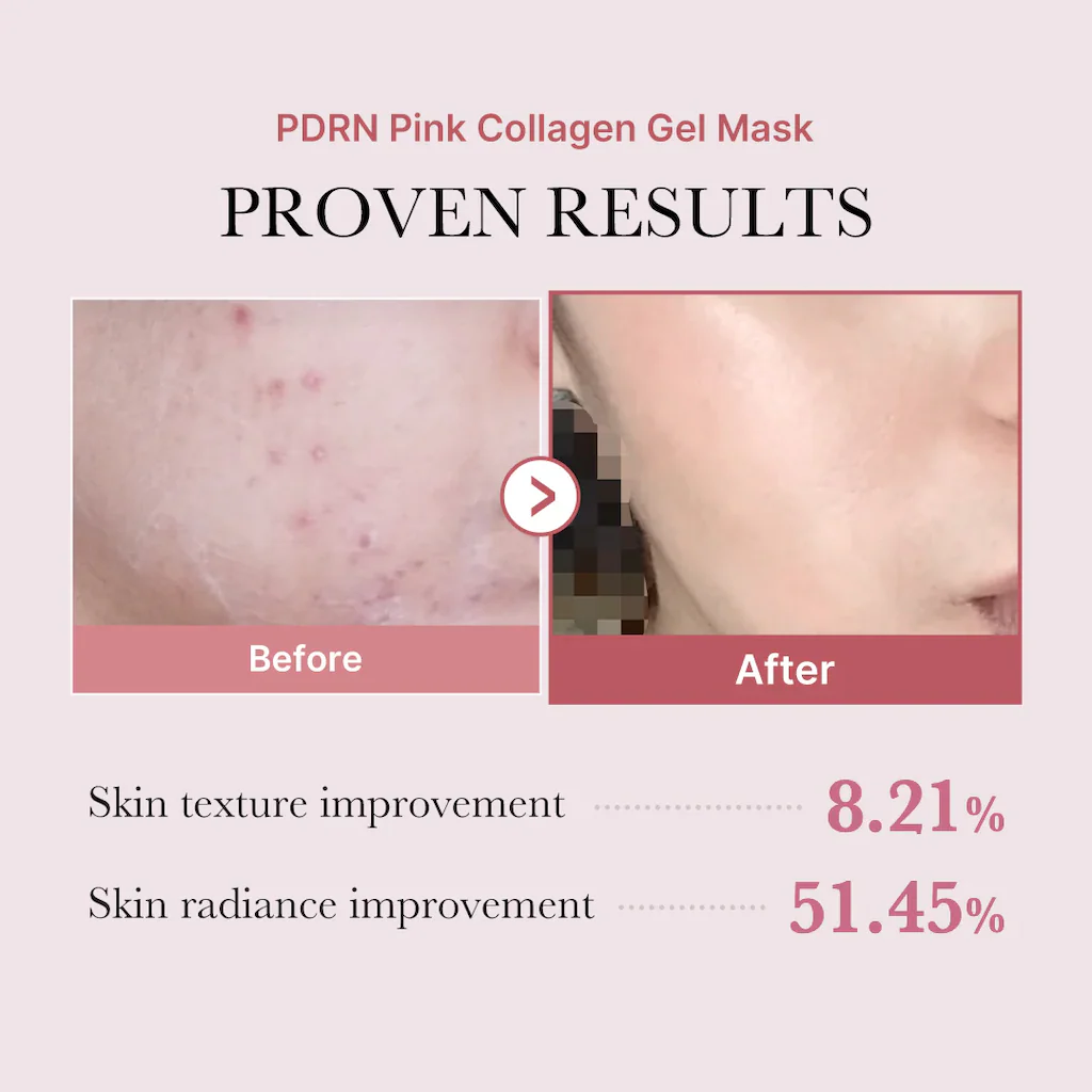PDRN Infused Pink Collagen Gel Mask - Pack of 4 - Image 3